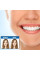 Виниры для зубов Perfect smile veneers. Голливудская улыбка