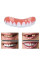 Виниры для зубов Perfect smile veneers. Голливудская улыбка