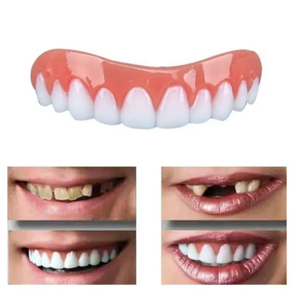 Виниры для зубов Perfect smile veneers. Голливудская улыбка