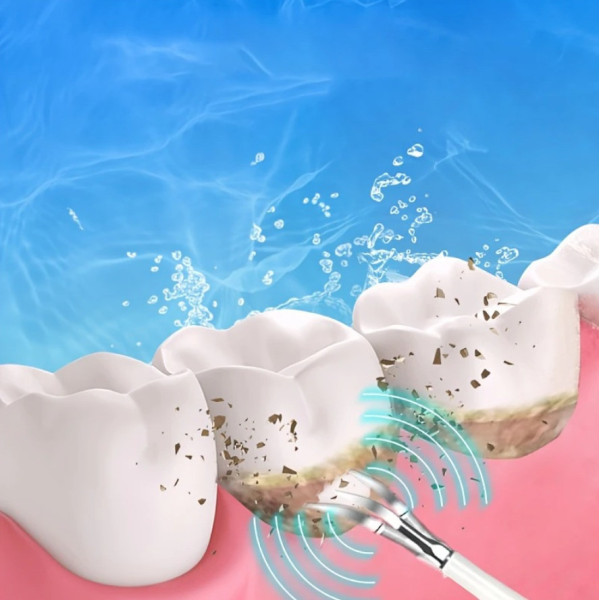 Ультразвуковая зубная щетка-скейлер 2в1 Electric Sonic Dental Scaler с насадками и зеркалом