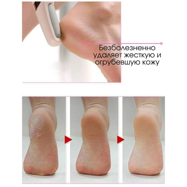 Flawless Pedi: Аккумуляторная Электрическая Пемза для Педикюра и Пяток