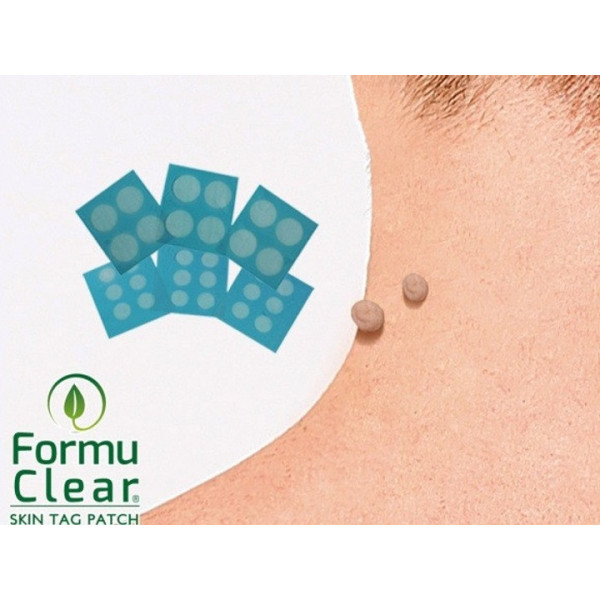 Пластырь от папиллом и бородавок Formula Clear с длительным действием и нанотехнологией