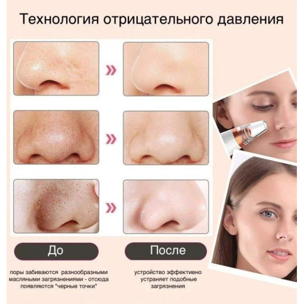 Вакуумный аппарат очиститель кожи и пор Multi-Functional для чистки лица